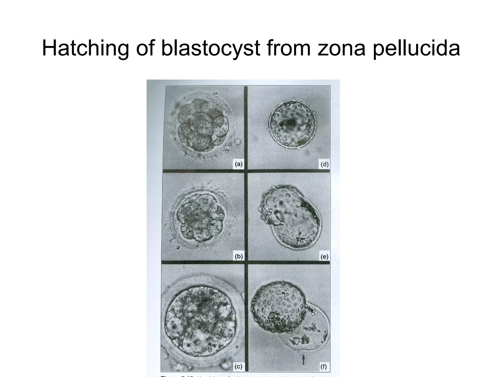 Hatching of blastocyst from zona pellucida
 