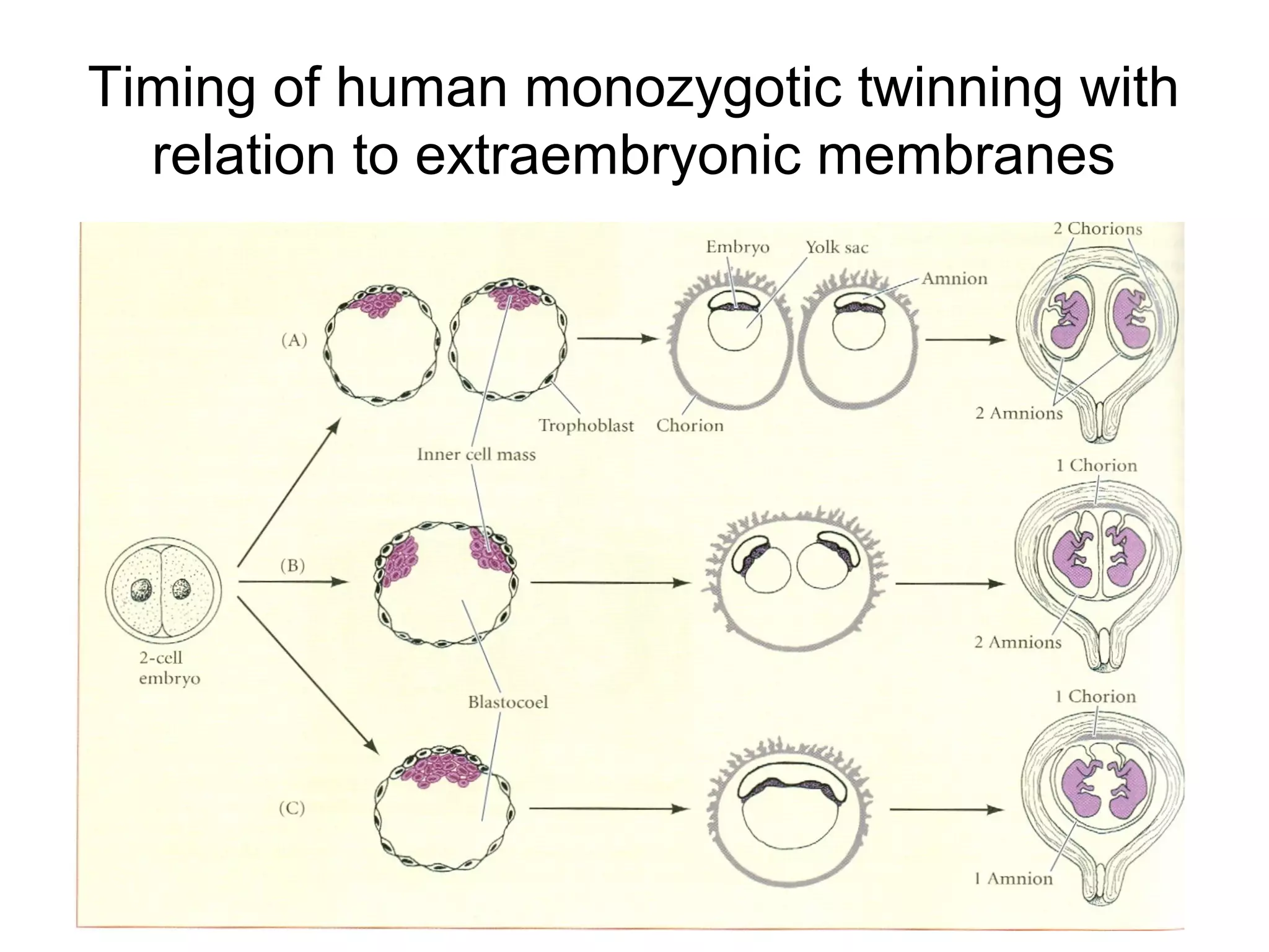 Timing of human monozygotic twinning with
  relation to extraembryonic membranes
 