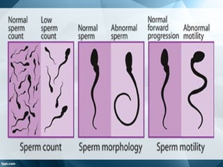 Spermatogeneza