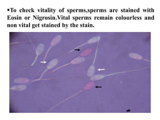 To check vitality of sperms,sperms are stained with
Eosin or Nigrosin.Vital sperms remain colourless and
non vital get stained by the stain.
 