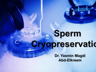 Sperm
Cryopreservatio
Dr. Yasmin Magdi
Abd-Elkreem
 