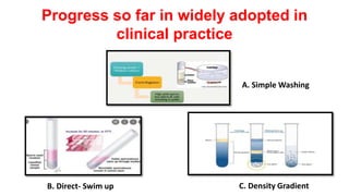 Progress so far in widely adopted in
clinical practice
B. Direct- Swim up C. Density Gradient
A. Simple Washing
 