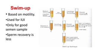 Swim-up
• Based on motility.
•Used for IUI
•Only for good
semen sample
•Sperm recovery is
less
 