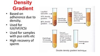 Density
Gradient
• Based on
adherence due to
density.
• Used for
IUI/IVF/ICSI
• Used for samples
with pus cells etc
• High recovery of
sperm
 