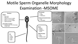 Motile Sperm Organelle Morphology
Examination -MSOME
 