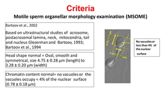 Criteria
Motile sperm organellar morphology examination (MSOME)
Bartoov et al., 2002
Based on ultrastructural studies of acrosome,
postacrosomal lamina, neck, mitocondria, tail
and nucleus Glezerman and Bartoov, 1993;
Bartoov et al., 1994
Head shape normal = Oval, smooth and
symmetrical, size 4.75 ± 0.28 μm (length) to
3.28 ± 0.20 μm (width)
Chromatin content normal= no vacuolesor the
vacuoles occupy < 4% of the nuclear surface
(0.78 ± 0.18 μm)
No vacuolesor
less than 4% of
thenuclear
surface
 