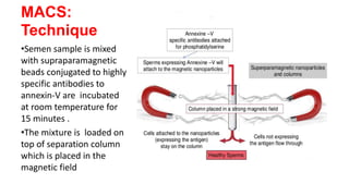 MACS:
Technique
•Semen sample is mixed
with supraparamagnetic
beads conjugated to highly
specific antibodies to
annexin-V are incubated
at room temperature for
15 minutes .
•The mixture is loaded on
top of separation column
which is placed in the
magnetic field
 