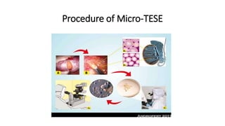 Procedure of Micro-TESE
 