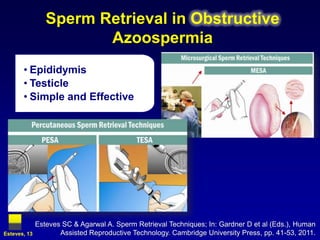 Sperm Retrieval in Obstructive
                        Azoospermia
       • Epididymis
       • Testicle
       • Simple and Effective




              Esteves SC & Agarwal A. Sperm Retrieval Techniques; In: Gardner D et al (Eds.), Human
Esteves, 13          Assisted Reproductive Technology. Cambridge University Press, pp. 41-53, 2011.
 