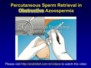 Percutaneous Sperm Retrieval in
       Obstructive Azoospermia




Please visit http://androfert.com.br/videos to watch this video
 