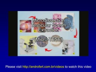 Please visit http://androfert.com.br/videos to watch this video
 