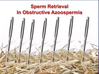 Sperm Retrieval
In Obstructive Azoospermia
 