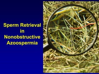 Sperm Retrieval
      in
Nonobstructive
 Azoospermia
 