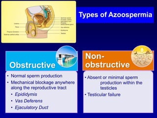 Types of Azoospermia




                                  Non-
 Obstructive                      obstructive
• Normal sperm production         • Absent or minimal sperm
• Mechanical blockage anywhere            production within the
  along the reproductive tract            testicles
  • Epididymis                    • Testicular failure
  • Vas Deferens
  • Ejaculatory Duct
 