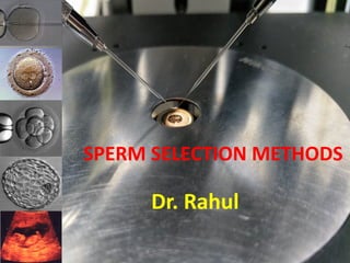 SPERM SELECTION METHODS
Dr. Rahul
 