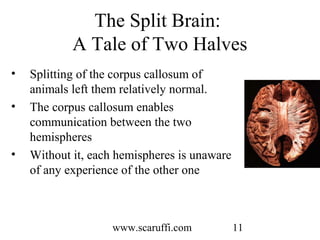 Roger Sperry and the Age of the Brain | PPT