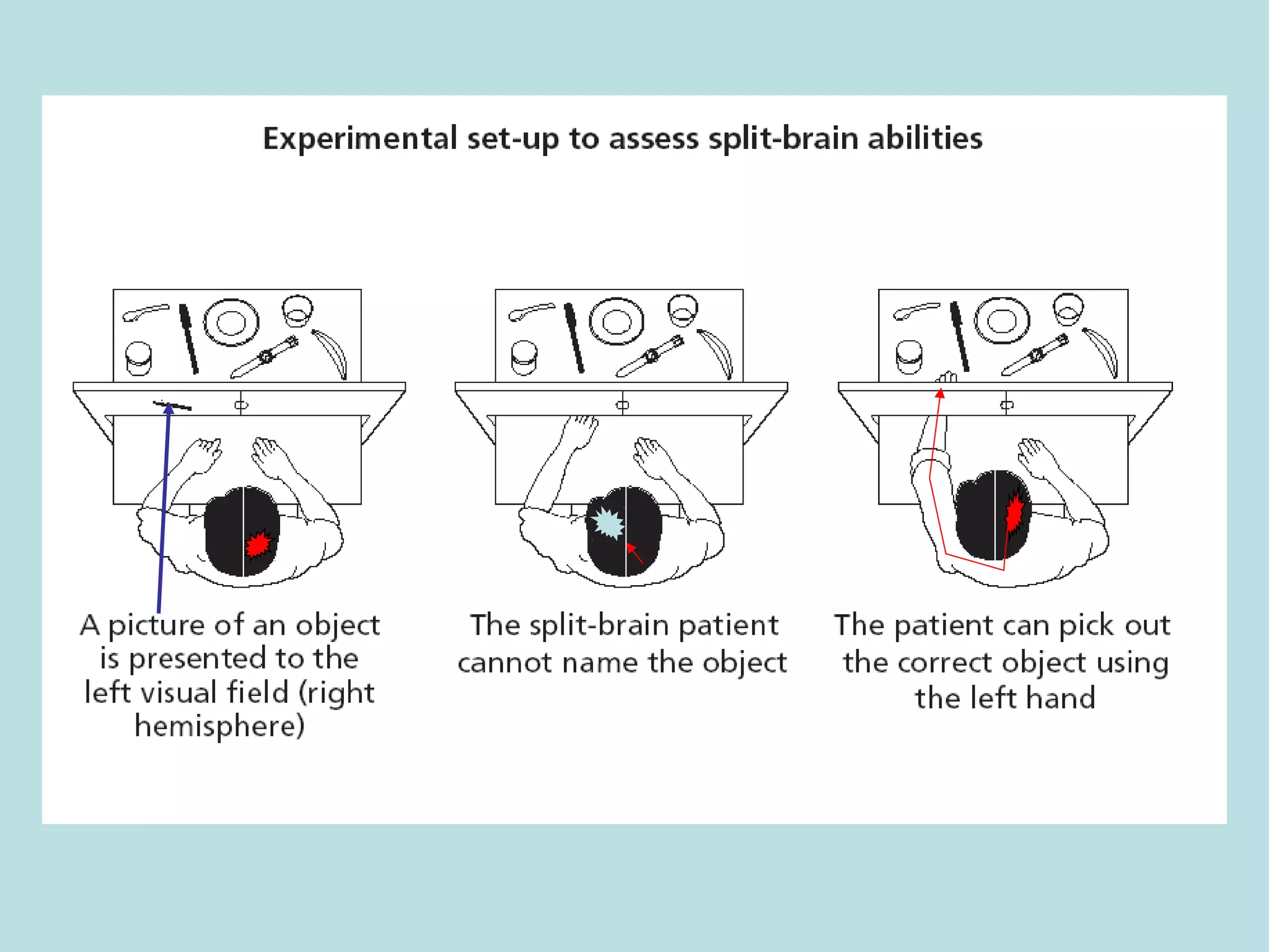 Sperry (1968) split brain study | PPT