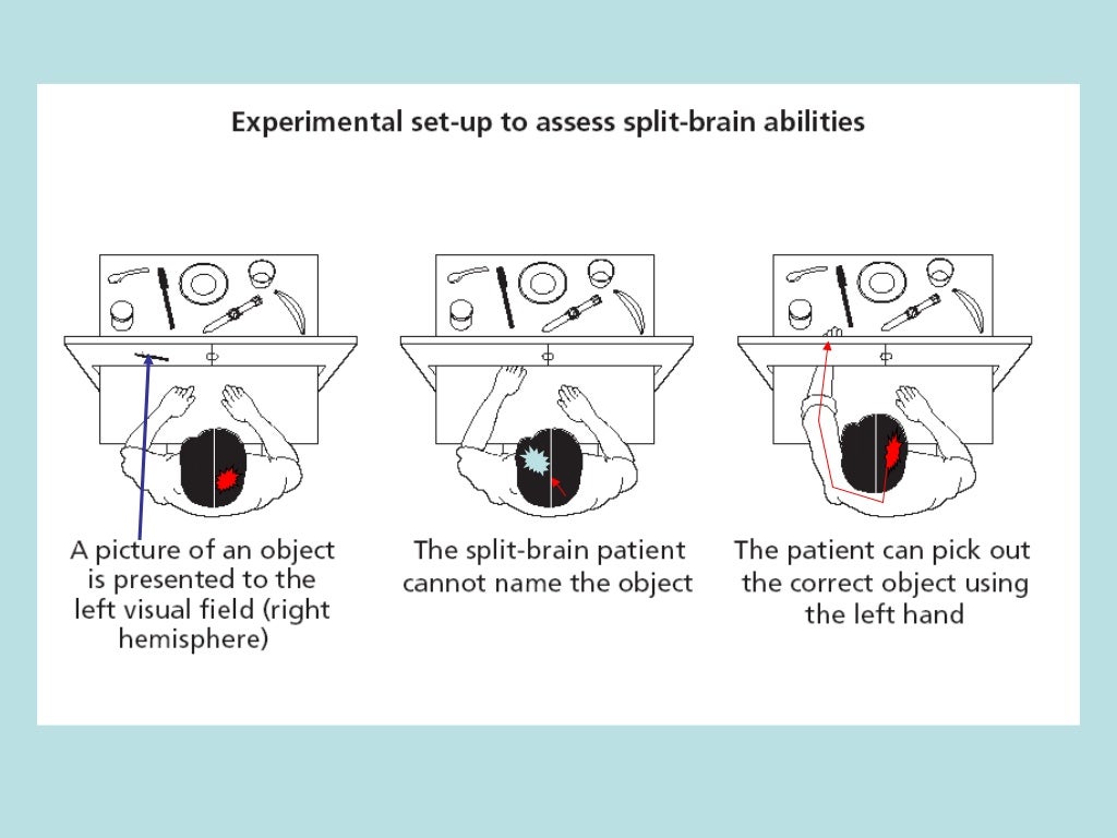Sperry (1968) split brain study