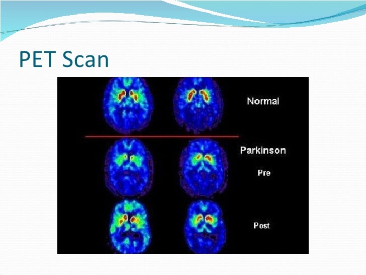 SPECT/PET Scans