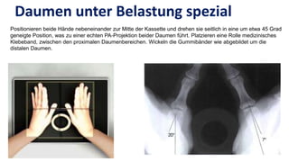 Spezielle roentgen aufnahmeb unfallchirurgie | PPTX