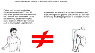 Spezielle roentgen aufnahmeb unfallchirurgie | PPT