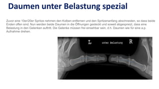 Spezielle roentgen aufnahmeb unfallchirurgie | PPT