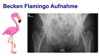 Spezielle roentgen aufnahmeb unfallchirurgie | PPT