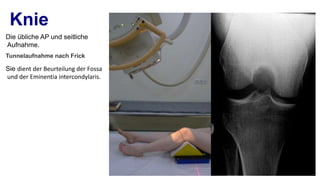 Spezielle roentgen aufnahmeb unfallchirurgie | PPT