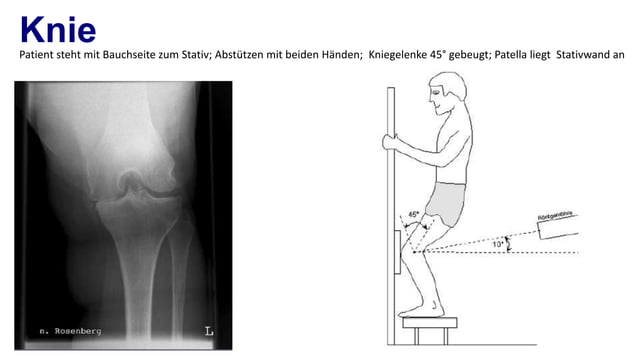 Spezielle roentgen aufnahmeb unfallchirurgie | PPT