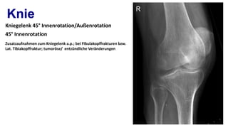 Spezielle roentgen aufnahmeb unfallchirurgie | PPT