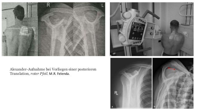 Spezielle roentgen aufnahmeb unfallchirurgie