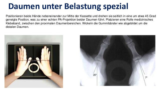 Spezielle roentgen aufnahmeb unfallchirurgie