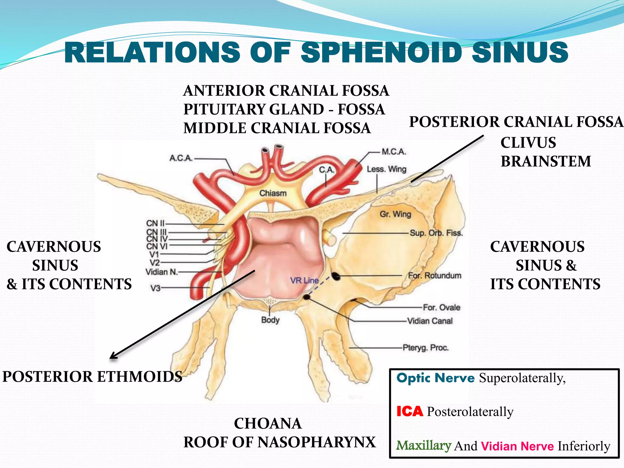 Sphenoid Sinus And Optic Nerve PPTX Sphenoid Sinus And Optic Nerve PPTX
