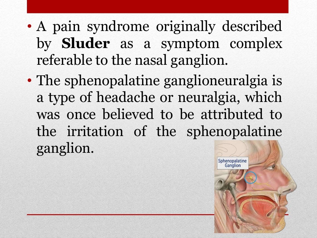 Sphenopalatine Neuralgia