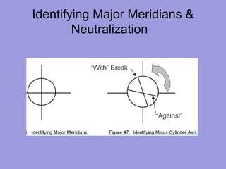 Identifying Major Meridians &
Neutralization
 