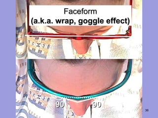 36
FaceformFaceform
(a.k.a. wrap, goggle effect)(a.k.a. wrap, goggle effect)
9090 9090
 