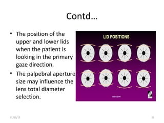 Spherical RGP contact lens fitting and prescribing | PPT