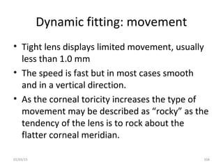 Dynamic fitting: movement
• Tight lens displays limited movement, usually
less than 1.0 mm
• The speed is fast but in most...