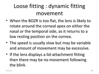 Loose fitting : dynamic fitting
movement
• When the BOZR is too flat, the lens is likely to
rotate around the corneal apex...