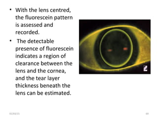 • With the lens centred,
the fluorescein pattern
is assessed and
recorded.
• The detectable
presence of fluorescein
indica...