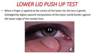 LOWER LID PUSH UP TEST
• When a finger is applied to the centre of the lower lid, the lens is gently
dislodged by digital upward manipulation of the lower eyelid border against
the lower edge of the contact lens.
 