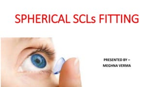 SPHERICAL SCLs FITTING
PRESENTED BY –
MEGHNA VERMA
 