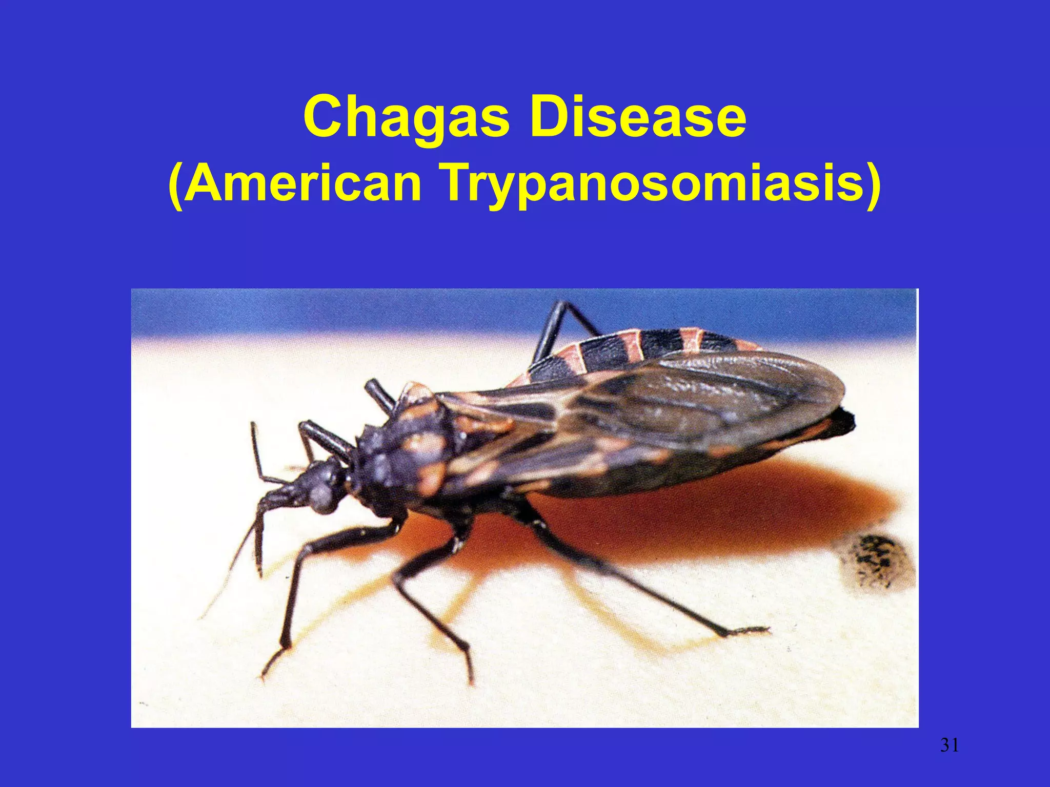 Chagas Disease
(American Trypanosomiasis)

31

 