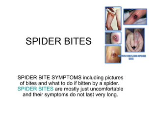 SPIDER BITES SPIDER BITE SYMPTOMS including pictures of bites and what to do if bitten by a spider.  SPIDER BITES  are mostly just uncomfortable and their symptoms do not last very long. 