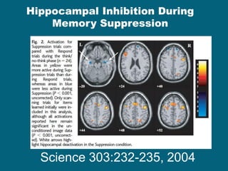 Science 303:232-235, 2004 
Hippocampal Inhibition During Memory Suppression  