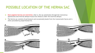 POSSIBLE LOCATION OF THE HERNIA SAC
 Most spigelian hernias are interstitial, that is, the sac penetrates through the transversus
aponeurosis and internal oblique muscle but dissects under the external oblique.
 The hernia sac consists of peritoneum and occasionally bands from the transversalis fascia and is
often preceded by preperitoneal fat.
 