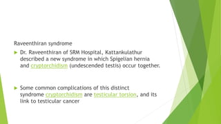Raveenthiran syndrome
 Dr. Raveenthiran of SRM Hospital, Kattankulathur
described a new syndrome in which Spigelian hernia
and cryptorchidism (undescended testis) occur together.
 Some common complications of this distinct
syndrome cryptorchidism are testicular torsion, and its
link to testicular cancer
 