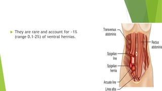  They are rare and account for ~1%
(range 0.1-2%) of ventral hernias.
 