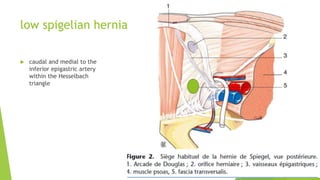 low spigelian hernias
 caudal and medial to the
inferior epigastric artery
within the Hesselbach
triangle
 