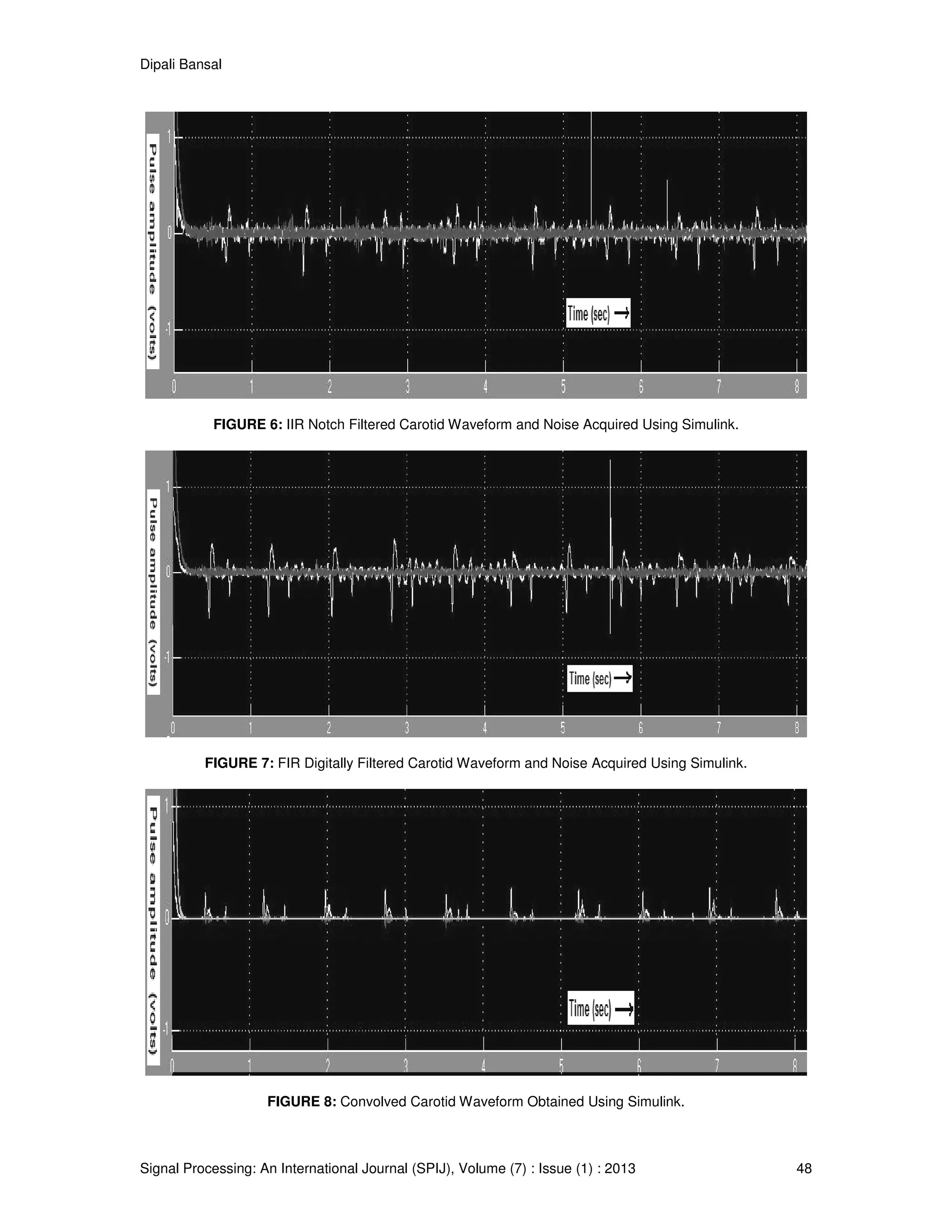 Dipali Bansal
Signal Processing: An International Journal (SPIJ), Volume (7) : Issue (1) : 2013 48
FIGURE 6: IIR Notch Filtered Carotid Waveform and Noise Acquired Using Simulink.
FIGURE 7: FIR Digitally Filtered Carotid Waveform and Noise Acquired Using Simulink.
FIGURE 8: Convolved Carotid Waveform Obtained Using Simulink.
 